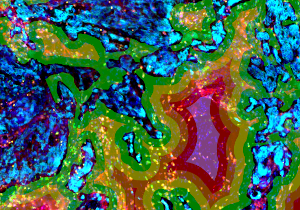 Webinar: Contextual Tissue Cytometry using Artificial Intelligence