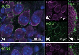 hcn expression