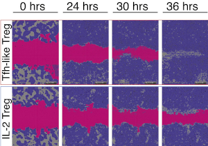 Tregs Tissue Repair