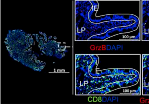 HIV CD8