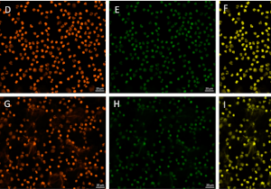 Neutrophil Extracelllular Traps
