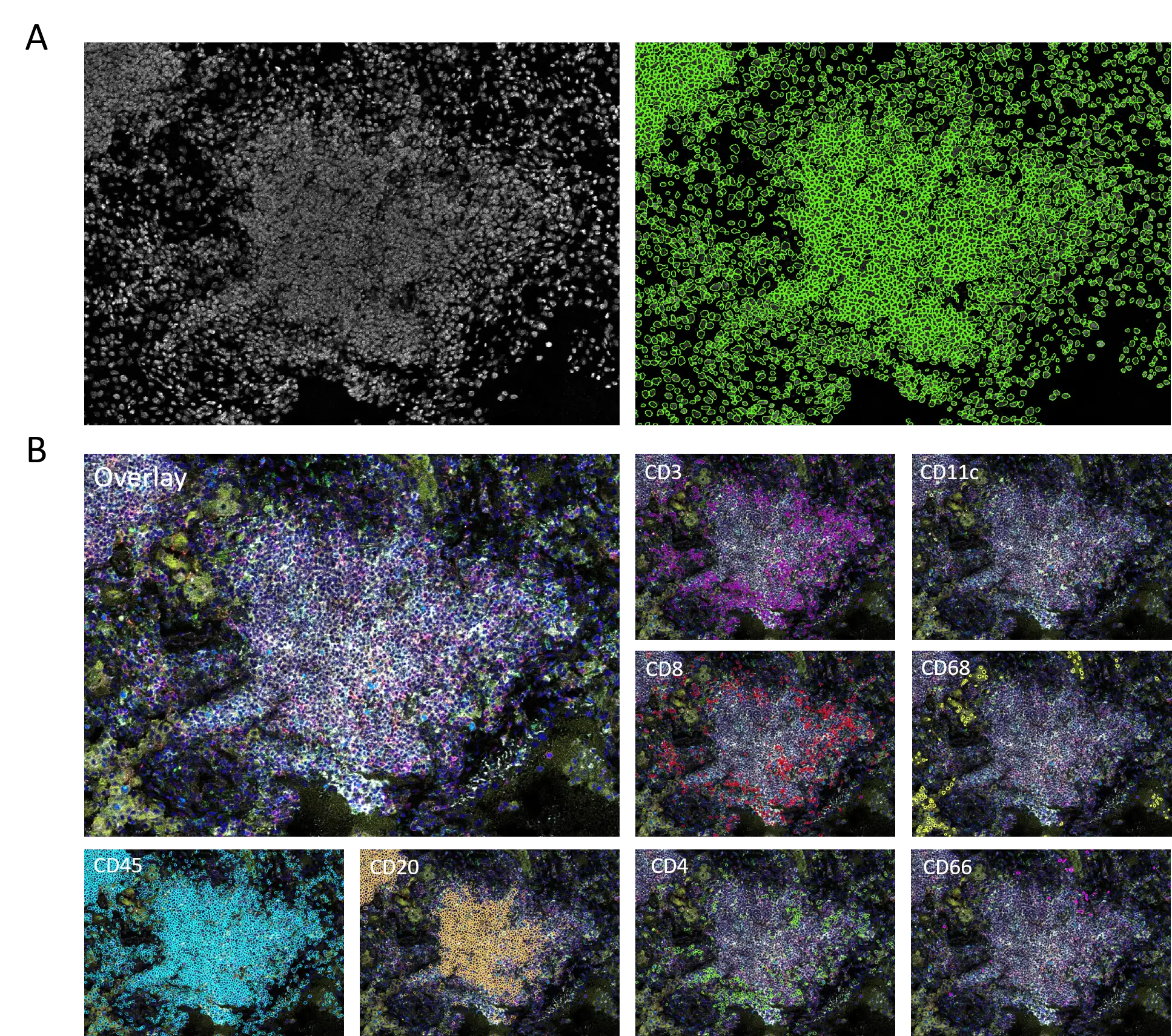 figure1_nuclei-segm_phenotypes_4