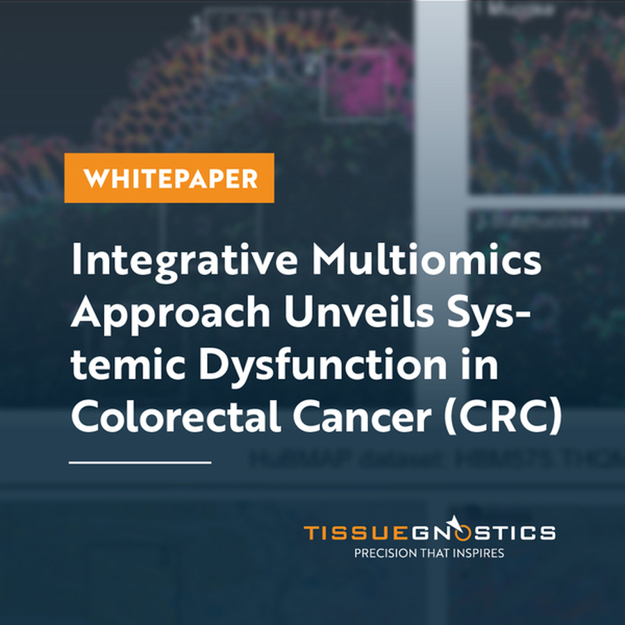 White Paper Integrative Multiomics Approach Unveils Systemic Dysfunction in Colorectal Cancer (CRC)