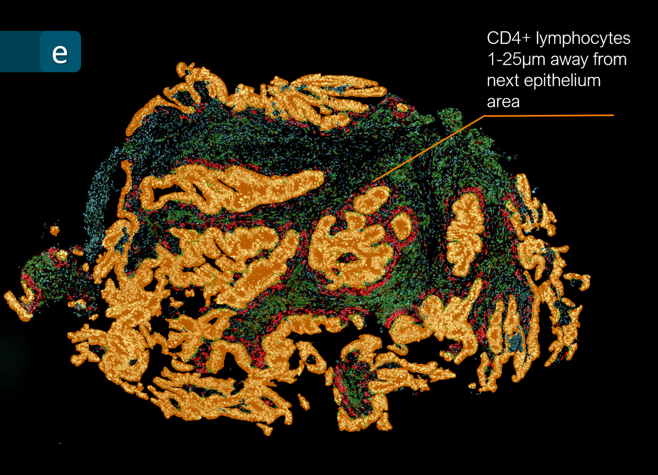 CRC CD4 25µm v1 min