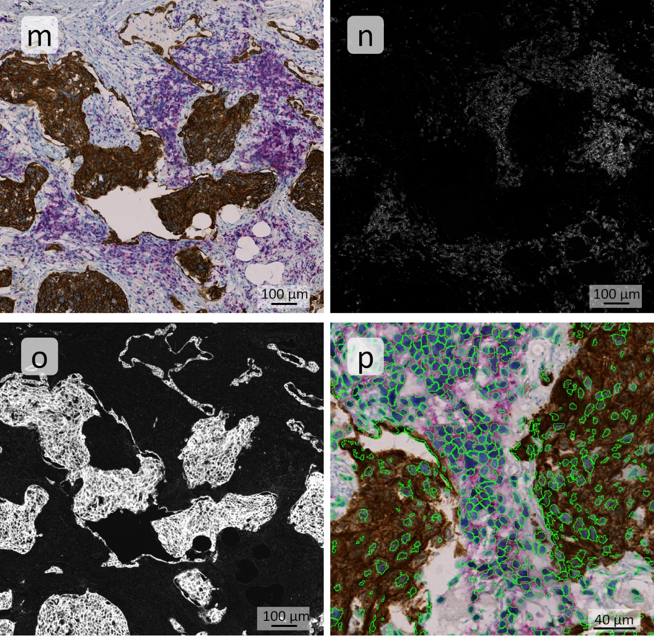Color sep IHC3 pic1 1