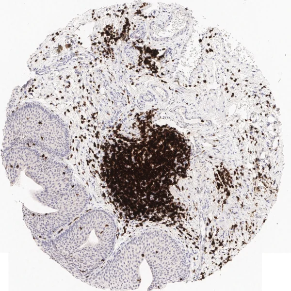 TMA Immune status Overview 15 cut