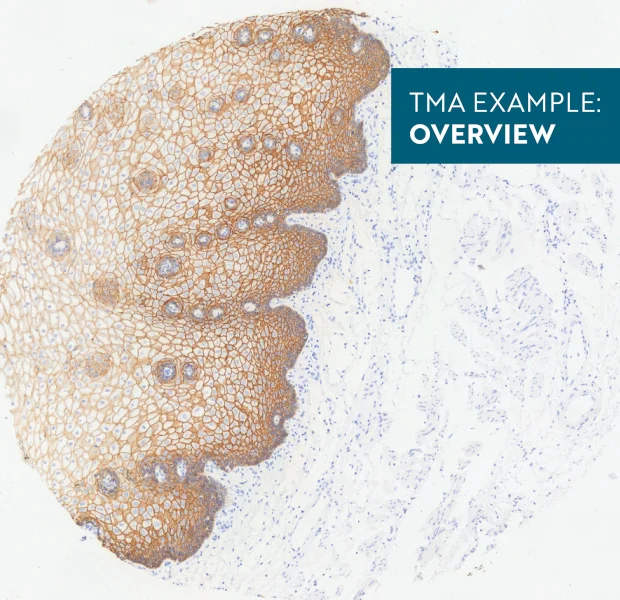 TMA Immune status Overview 15 name