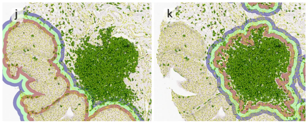 TissueClassification2 cut