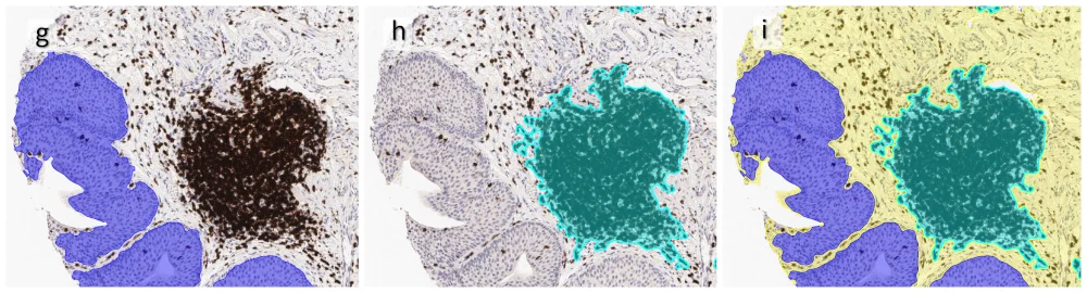 TissueClassification cut