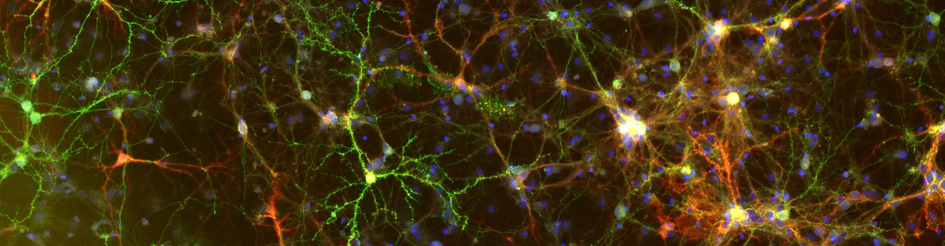 TissueFAXS Viewer immunofluorescent neuron image. The text reads TissueFAXS Viewer, Free Viewer Software