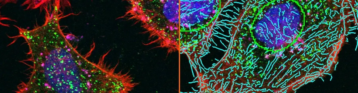 Successful Research with TissueGnostics
