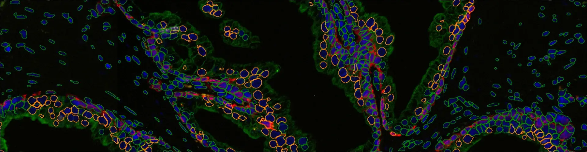  immunofluorescence image with detected nuclei. The text reads TissueQuest Multichannel Tissue Cytometry