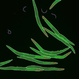 EBER ISH EBER ISHcells 274x274