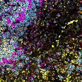 IFRetinalVasculature VesselsVesselsSkeletononOverlay 274x274