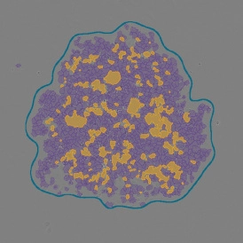 EBER ISH EBER ISHcells 274x274