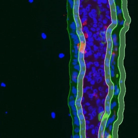 EBER ISH EBER ISHcells 274x274