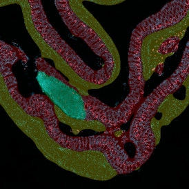 Dynamic Content Image